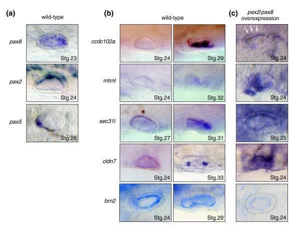This composite of clinical diagnostic images depicts gene expression patterns in medaka embryos during otic vesicle development, serving as a model for vertebrate inner ear morphogenesis. (a) In wild-type embryos, pax8 (stage 23), pax2 (stage 24), and pax5 (stage 26) show localized purple staining in the otic vesicle epithelium, highlighting their role as upstream regulators. (b) Wild-type expression of downstream candidate genes is shown across stages 24 to 33. ccdc102a transitions from absent to medioventral expression by stage 29; metrnl appears weakly at stage 32; sec31l shifts from general epithelium (stage 27) to medial localization (stage 31); cldn7 is broadly expressed at stage 24 and restricted to medial cristae by stage 33; and brn2 remains restricted to the medial part throughout. (c) Experimental over-expression of pax2/pax8 demonstrates regulatory relationships, where target genes like ccdc102a, mtrnl, sec31l, and cldn7 show ectopic, intensified staining, while brn2 exhibits transcriptional repression (decreased staining) at stage 24. These images illustrate molecular pathways in developmental biology and auditory system embryology.