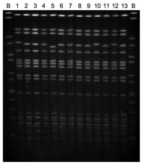 This diagnostic molecular image illustrates a pulsed-field gel electrophoresis (PFGE) analysis used for the genetic fingerprinting of bacterial isolates. The gel consists of 15 lanes: two flanking control lanes (labeled 'B') containing Salmonella Braenderup H9812 DNA size standards, and 13 internal lanes (1-13) containing chromosomal DNA from Salmonella enterica serovar Virchow isolates. The image displays characteristic macrorestriction patterns consisting of multiple horizontal fluorescent bands of varying molecular weights. The visual similarity across lanes 1-13, with only minor 1-2 band differences observed in specific samples (e.g., lanes 5, 9, and 10), demonstrates a high degree of genetic relatedness or clonality among these rmtC-positive clinical isolates. This laboratory technique is essential in infectious disease epidemiology to track the transmission of antibiotic-resistant pathogens and identify potential outbreak clusters by comparing genomic patterns across different clinical and environmental sources.