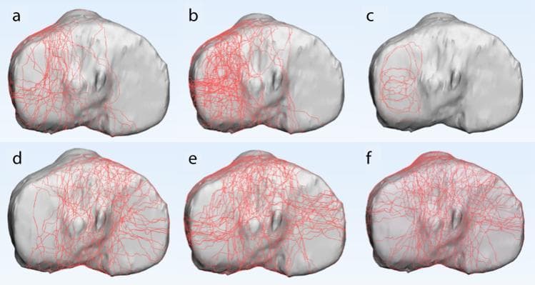 This diagnostic comparison chart presents six 3D reconstructions (labeled a–f) of a human left tibial plateau in an axial view, demonstrating fracture mapping across Schatzker types I–VI. Red lines represent anatomical fracture trajectories mapped onto a standard 3D tibial model. Panels 'a', 'b', and 'c' illustrate fractures primarily involving the lateral tibial plateau, consistent with Schatzker types I (pure cleavage), II (cleavage with depression), and III (pure depression). Panel 'b' specifically shows a higher density of comminution compared to 'a'. Panel 'd' represents Schatzker type IV, showing fracture lines localized to the medial plateau. Panels 'e' and 'f' represent Schatzker types V (bicondylar) and VI (bicondylar with metadiaphyseal dissociation), respectively, exhibiting extensive, high-density fracture networks that cross both medial and lateral compartments and the intercondylar eminence. This anatomical diagram serves as an educational tool for orthopedic surgical planning, highlighting fracture morphology and the distribution of mechanical failure across different injury mechanisms.