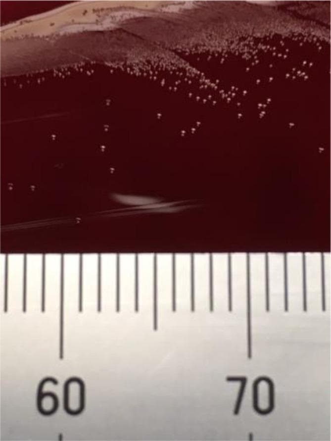 A diagnostic laboratory photograph showing bacterial colonies of Finegoldia sanguinis cultured on a Brucella blood agar plate. The image depicts numerous small, pinpoint, round colonies with a white to off-white appearance, contrasting against the deep red background of the agar medium. The colony distribution exhibits a density gradient: there is a high-density cluster (confluence) in the upper section of the plate, transitioning to more isolated, discrete colonies toward the center, while the lower portion remains relatively clear of growth. Along the bottom edge of the frame, a calibrated metric ruler with millimeter markings (labeled '60' and '70') is included to provide a scale for morphology measurement. This visual demonstrates the typical growth characteristics and colonial morphology of F. sanguinis, an anaerobic gram-positive coccus, which is clinically significant in various infections, including urinary tract and soft tissue involvements.