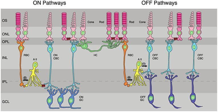 This pathophysiology diagram illustrates the functional retinal circuitry of the ON and OFF pathways. The vertical organization of the retina is shown across six distinct layers: Outer Segments (OS), Outer Nuclear Layer (ONL), Outer Plexiform Layer (OPL), Inner Nuclear Layer (INL), Inner Plexiform Layer (IPL), and Ganglion Cell Layer (GCL). The diagram depicts key cell types and their synaptic relationships: Rods and Cones (photoreceptors) in the outer layers; Rod Bipolar Cells (RBC) and Cone Bipolar Cells (ON CBC and OFF CBC) in the INL; Horizontal Cells (HC) providing lateral inhibition in the OPL; and AII Amacrine Cells facilitating signal transfer. The ON pathway demonstrates rod signals traversing RBCs to AII cells, which سپس stimulate ON Ganglion Cells (ON GC). The OFF pathway shows direct transmission from photoreceptors via OFF CBCs to OFF Ganglion Cells (OFF GC). This schematic serves as a high-level educational resource for understanding neuro-ophthalmology, visual signal processing, and the stratification of the human retina.
