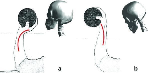 This Comparison Chart uses a conceptual analogy to illustrate the biomechanics of cervical spine posture. The image is divided into two sections: (a) representing correct alignment and (b) representing incorrect alignment or Forward Head Posture (FHP). In section (a), an anatomical diagram of the skull shows it balanced directly over the cervical vertebrae with a natural 'C-shaped' lordotic curve. This is paralleled by an illustration of an arm holding a weighted ball, where a red line indicates a curved, efficient support alignment through the wrist. In section (b), the skull is displaced anteriorly (forward), causing a straightened or reversed cervical curve and increased mechanical stress. The corresponding arm illustration shows the hand and ball shifted forward, resulting in an angled red line that demonstrates the increased moment and tension required by the wrist and forearm muscles to support the weight. The educational focus is on the clinical significance of head displacement and its relationship to neck strain and musculoskeletal tension.