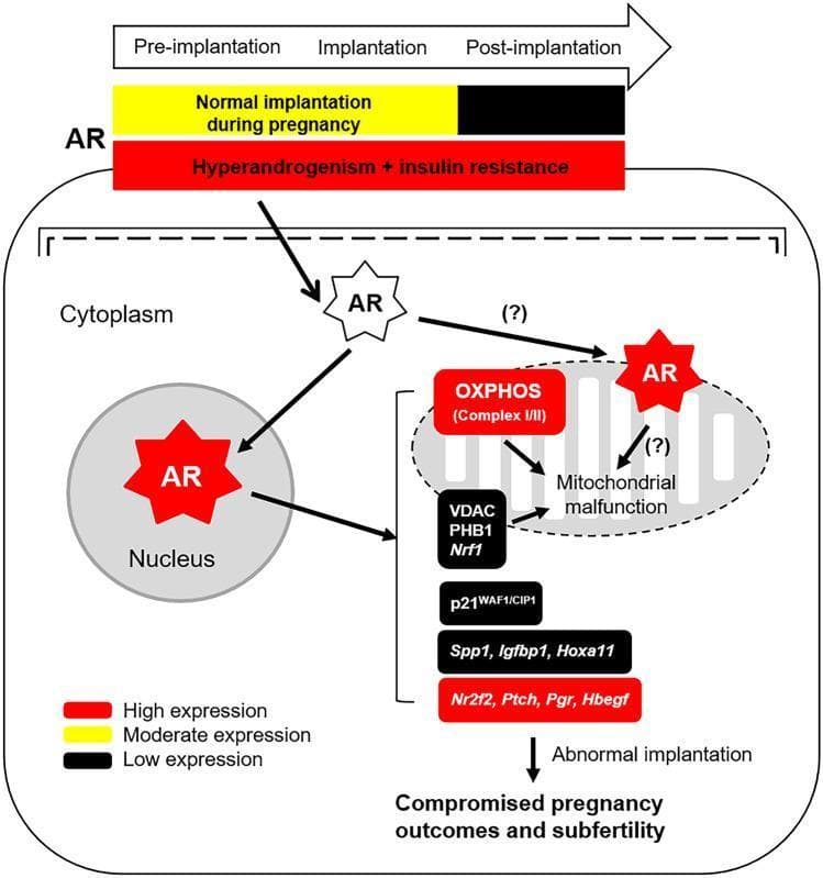 This pathophysiology diagram illustrates the dysregulation of the Androgen Receptor (AR) signaling pathway in the gravid uterus under conditions of hyperandrogenism and insulin resistance. A temporal comparison at the top shows that in normal pregnancy, AR expression transitions from moderate (yellow) during pre-implantation and implantation to low (black) post-implantation. In contrast, hyperandrogenism + insulin resistance maintains sustained high (red) AR expression across all stages. The cellular model depicts high AR expression (red star symbols) localized within the nucleus, cytoplasm, and mitochondrion. Nuclear AR translocation affects the transcription of implantation-related genes, including p21WAF1/CIP1, Spp1, Igfbp1, and Hoxa11, as well as Nr2f2, Ptch, Pgr, and Hbegf. Concurrently, mitochondrial AR localization and interaction with OXPHOS (Complex I/III), VDAC, PHB1, and Nrf1 contribute to mitochondrial malfunction. These combined molecular disturbances lead to abnormal implantation, compromised pregnancy outcomes, and subfertility, modeling mechanisms often associated with Polycystic Ovary Syndrome (PCOS).