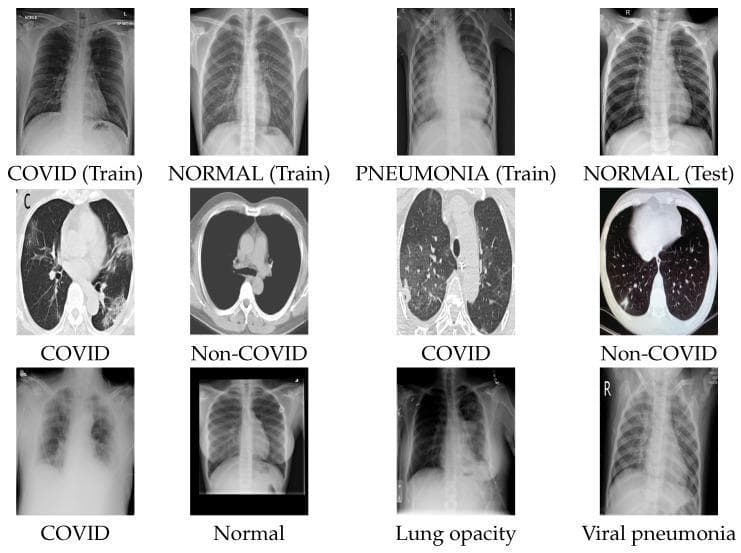 This composite educational graphic presents a comparison of diagnostic imaging for COVID-19 and other respiratory conditions across three distinct datasets. The first and third rows feature Chest X-ray (CXR) images. Row one displays 'COVID (Train)' showing peripheral ground-glass opacities, 'NORMAL (Train)' with clear lung fields, 'PNEUMONIA (Train)' with dense bilateral consolidation, and 'NORMAL (Test)'. Row three contrasts 'COVID' presenting with diffuse, hazy pulmonary infiltrates against 'Normal', 'Lung opacity' (localized dense consolidation), and 'Viral pneumonia' (interstitial markings). The second row utilizes Axial Computed Tomography (CT) scans to contrast 'COVID' pathology with 'Non-COVID' controls. The COVID-positive CT images demonstrate characteristic multifocal ground-glass opacities (GGO) and areas of consolidation within the lung parenchyma, while the Non-COVID images show clear parenchyma and normal thoracic anatomy. This visual aid is designed for medical training in radiological differentiation between COVID-19, typical viral pneumonia, and healthy thoracic structures, highlighting key diagnostic features such as opacity distribution, texture, and lung field clarity.