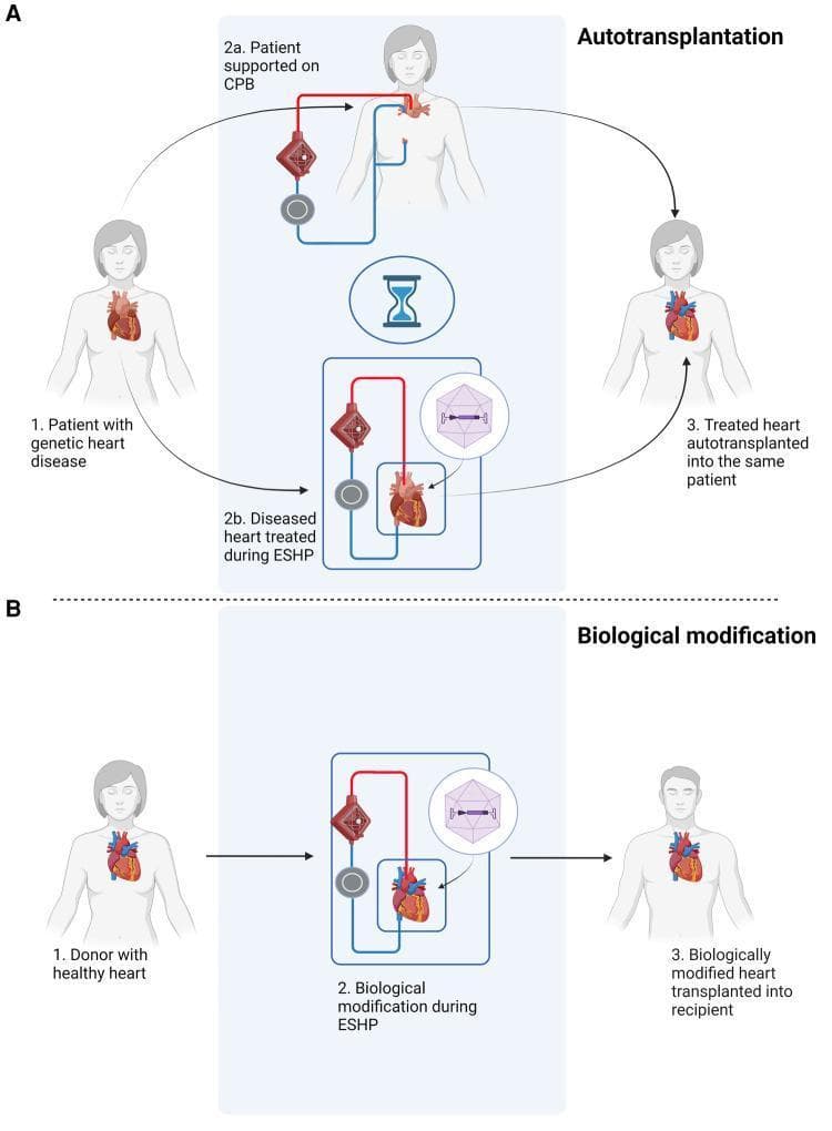 This medical schematic illustrates two clinical pathways for gene therapy application during ex situ heart perfusion (ESHP). Pathway A depicts autotransplantation for genetic heart disease. It shows a sequence where a diseased heart is removed for ESHP treatment, during which the patient is supported by a cardiopulmonary bypass (CPB) circuit. The ESHP phase highlights the use of viral vectors (represented by icosahedral icons) for targeted gene editing before the treated organ is autotransplanted back into the same patient. Pathway B illustrates biological modification for orthotopic heart transplantation. A healthy donor heart undergoes ESHP for immunomodulation or physiological enhancement—again using viral vector delivery—prior to transplantation into a recipient. Both pathways utilize a perfusion circuit consisting of a pump and an oxygenator to maintain organ viability ex situ. This diagram emphasizes the clinical potential of ESHP as a controlled environment for localized cardiovascular gene therapy and organ optimization in transplant medicine.