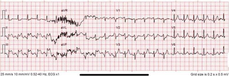 Hugging Face pmc clinical VQA raw