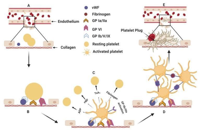 This hematology diagram illustrates the multistep pathophysiology of primary hemostasis following endothelial injury. The process is divided into five sequential stages (AβE). (A) Endothelial disruption exposes subendothelial collagen. (B) Platelet adhesion occurs as resting platelets (smooth, discoid) bind to collagen via surface glycoprotein receptors GP Ia/IIa, GP VI, and GP Ib/V/IX mediated by von Willebrand factor (vWF). (C) Platelet activation results in a dramatic morphological transformation, with platelets developing multiple cytoplasmic pseudopodia (starburst shape). This stage shows the release of granular contents including ADP, TxA2, vWF, and fibrinogen, which recruit additional platelets. (D) Platelet aggregation is shown, where activated GP IIb/IIIa receptors form cross-links between adjacent platelets using vWF and fibrinogen as molecular bridges. (E) The sequence concludes with the formation of a stable platelet plug at the injury site, effectively sealing the vascular breach. This educational visual explains the cellular signaling and mechanical interactions required for initial thrombus formation.