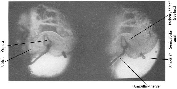 Hugging Face pmc clinical VQA raw