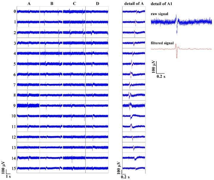 Electrophysiological data visualization showing action potential (AP) propagation in HL-1 cardiac muscle cells using a planar microelectrode array (pMEA). The image is divided into three panels. The left panel displays a grid of signal recordings across 16 rows (0-15) and four columns (A, B, C, D), illustrating the spatiotemporal distribution of APs over a 1-second interval. The center panel, 'detail of A', provides a high-resolution view of AP propagation within a single electrode column over a 0.2-second window, highlighting the sequential firing indicative of cellular conduction. The right panel compares the 'raw signal' and 'filtered signal' from a specific electrode (A1). The raw signal exhibits significant high-frequency background noise, while the filtered version (5–50 Hz bandpass) demonstrates a clarified, biphasic waveform with an improved signal-to-noise ratio. Scale bars indicate voltage in microvolts (100 µV) and time in seconds (1 s or 0.2 s). This figure demonstrates the capability of pMEAs to track rhythmic, propagating electrical activity in cultured cardiomyocytes.