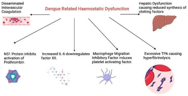 This medical pathophysiology diagram outlines the multifaceted mechanisms of 'Dengue Related Haemostatic Dysfunction'. The central heading branches into six key pathogenic pathways. On the left, a blood vessel illustration demonstrates Disseminated Intravascular Coagulation (DIC) with fibrin-platelet aggregates and trapped red blood cells. On the right, an anatomical liver illustration highlights hepatic dysfunction leading to reduced synthesis of clotting factors. The lower section details molecular and cellular interference: NS1 protein inhibiting prothrombin activation (shown as a hexameric molecular structure); increased IL-6 downregulating factor XII (illustrated via a signaling pathway map); Macrophage Migration Inhibitory Factor inducing platelet-activating factor (represented by an activated immune cell); and excessive Tissue Plasminogen Activator (TPA) causing hyperfibrinolysis, depicted as a microscopic view of fibrin degradation and clot dissolution. This infographic serves as an educational summary of how dengue virus proteins and host inflammatory responses collectively cause coagulopathy and thrombocytopenia.