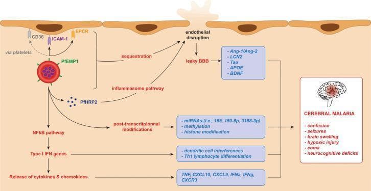 This pathophysiology diagram illustrates the molecular and cellular mechanisms of Plasmodium falciparum-induced cerebral malaria. The diagram depicts an infected red blood cell (iRBC) expressing PfEMP1, which facilitates cytoadherence and sequestration by binding to endothelial receptors CD36 (via platelets), ICAM-1, and EPCR. Simultaneously, the iRBC releases PfHRP2, activating the inflammasome pathway, and triggers the NFkB pathway leading to Type I IFN gene activation and the release of pro-inflammatory cytokines/chemokines (TNF, CXCL10, IFNg). These cascades result in endothelial disruption and a leaky blood-brain barrier (BBB), causing the release of biomarkers such as Ang-1/Ang-2, LCN2, Tau, APOE, and BDNF. Other highlighted processes include post-transcriptional modifications (miRNAs, methylation, histone modification) and immune cell interferences (Th1 differentiation). The culmination of these processes leads to the clinical manifestations of cerebral malaria listed in the final panel: confusion, seizures, brain swelling, hypoxic injury, coma, and neurocognitive deficits.