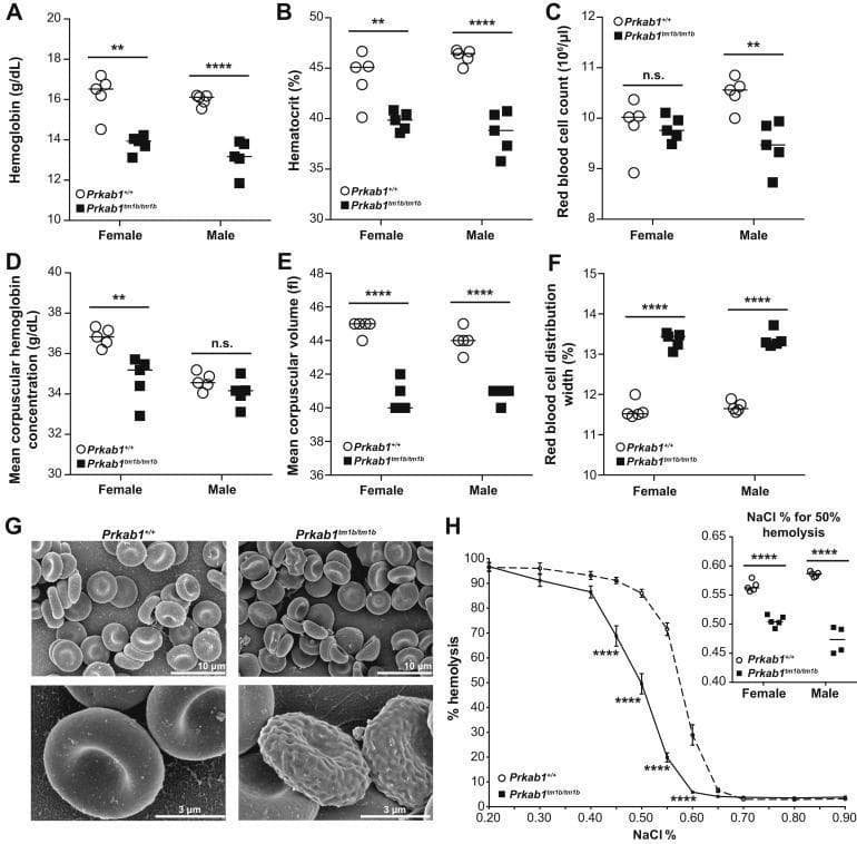 Educational figure illustrating hematological abnormalities in a murine model of Prkab1 deficiency, serving as a surrogate for studying human hemolytic anemia and microcytosis. Panels A-F present dot plots of hematological indices for wild-type (Prkab1+/+) and deficient (Prkab1tm1b/tm1b) mice, showing significant reductions in hemoglobin (A), hematocrit (B), and mean corpuscular volume (E), with a concomitant increase in red blood cell distribution width (F), indicating microcytic anemia with anisocytosis. Panel G contains high-resolution Scanning Electron Microscopy (SEM) images comparing erythrocyte morphology; wild-type cells show standard biconcave discocyte morphology, whereas Prkab1-deficient cells exhibit poikilocytosis with numerous abnormal forms, including acanthocytes, schistocytes, and echinocytes with irregular surface protrusions. Panel H displays an osmotic resistance curve, where Prkab1-deficient erythrocytes demonstrate a left-ward shift, signifying increased osmotic resistance (delayed hemolysis) compared to wild-type controls. The inset confirms a lower NaCl percentage required for 50% hemolysis in deficient cells, indicating altered membrane stability.