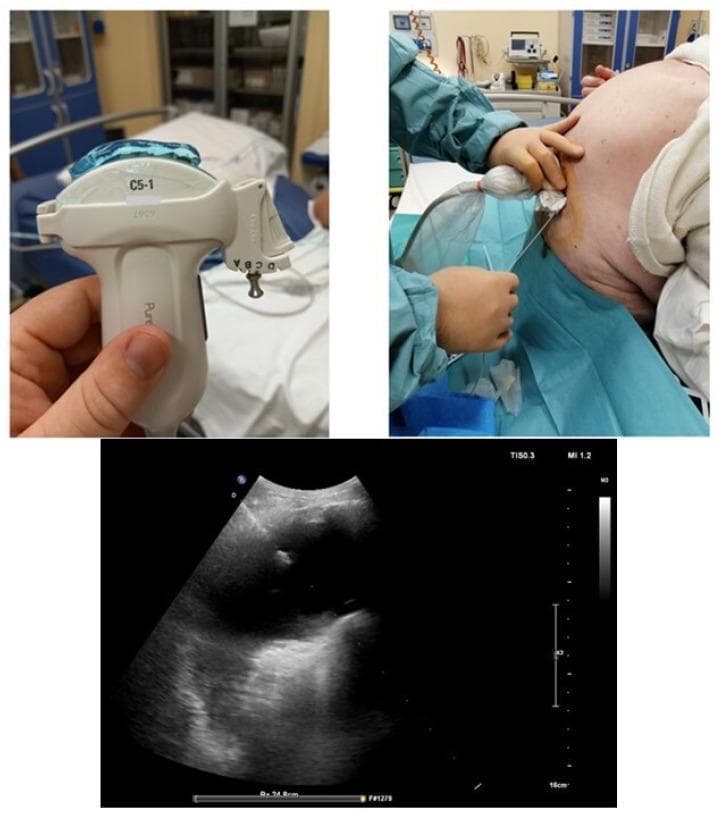 Hugging Face pmc clinical VQA raw