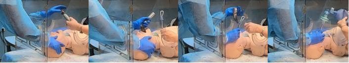 This sequence of clinical images demonstrates the four steps of endotracheal intubation (ETI) using a polycarbonate barrier box on an airway trainer manikin. The setup is designed to minimize aerosol exposure during airway management. Step 1: An operator wearing personal protective equipment (PPE), including blue gloves, inserts hands through the rear access ports of the transparent box to begin laryngoscopy. Step 2: The operator uses a Macintosh blade laryngoscope to visualize the glottis while an assistant provides a 7.0 mm cuffed endotracheal tube through a side port. Step 3: The operator inserts the tracheal tube into the trachea. Step 4: The tube is secured, the cuff is inflated, and an Ambu-Bag (manual resuscitator) is connected to begin positive-pressure ventilation. The images highlight the ergonomic constraints and procedural adjustments required when performing direct laryngoscopy within a confined barrier enclosure, commonly utilized in protocols for highly infectious respiratory diseases such as COVID-19.