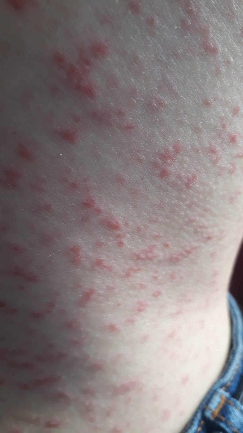 Hugging Face pmc clinical VQA raw