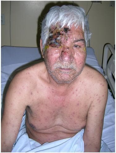 Hugging Face pmc clinical VQA raw