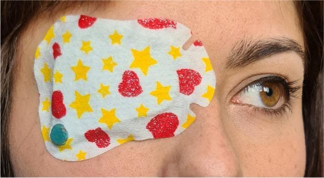 This clinical photograph displays a pediatric occlusion patch applied to the left eye of a patient, a standard intervention for treating conditions like amblyopia and strabismus. The adhesive patch features a decorative pattern of yellow stars and red hearts on a white background, designed to improve treatment compliance in younger populations. A key clinical feature of this setup is the TheraMon® microsensor (dimensions approximately 9 x 13 x 4.5 mm), visible as a small turquoise circular object through a deliberate perforation at the lateral inferior margin of the patch. This electronic monitor is used to objectively record wearing time and adherence by measuring environmental temperature at 15-minute intervals. The right eye remains uncovered, showing a healthy hazel iris, dark limbal ring, and normal periocular skin, which serves as a comparison. The image illustrates the integration of digital health monitoring with traditional occlusion therapy to track the dose rate of treatment, which is a critical factor in achieving visual acuity gains in pediatric ophthalmology.