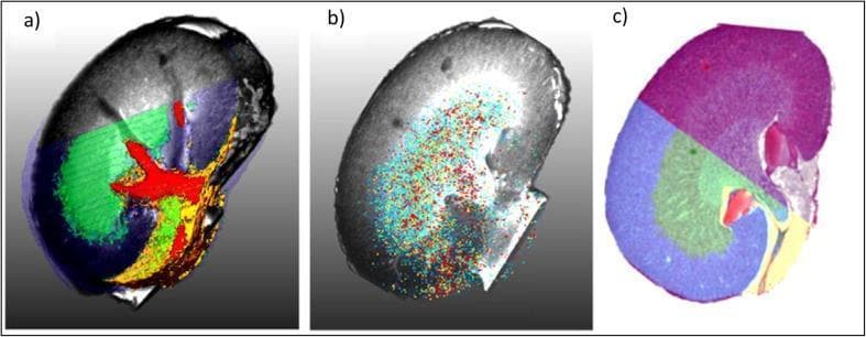 This composite figure illustrates a multimodal imaging study of a kidney, integrating radiological, molecular, and histological data. Panel (a) presents a semi-transparent 3D MRI volume rendering fused with molecular clusters derived from 3D MALDI Mass Spectrometry Imaging (MSI). The spatial distribution of renal compartments is color-coded: the renal cortex is shown in blue forming the outer parenchyma, the renal medulla in green, and the renal pelvis as a central branching red structure. Panel (b) shows the spatial localization of a specific ion species (m/z 4808) overlaid on the MRI volume, demonstrating molecular mapping within the anatomical framework. Panel (c) displays an H&E-stained histological cross-section of the inner kidney co-registered with a 3D segmentation map. The histology reveals distinct tissue architecture including the cortex (purple/blue), medulla (green), and hilar structures. This visualization demonstrates the clinical relevance of combining molecular MSI data with traditional diagnostic imaging and pathology for enhanced tissue characterization and anatomical-molecular correlation.