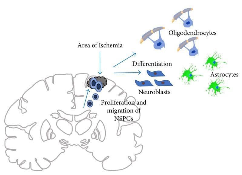 This pathophysiology diagram illustrates the endogenous response to ischemic stroke within a coronal section of the brain. The diagram focuses on the proliferation and migration of neural stem and progenitor cells (NSPCs) following injury. Small, round blue cells representing NSPCs are shown originating from the subventricular zone (SVZ) and migrating toward a dark gray-shaded 'Area of Ischemia' in the cerebral cortex. The visual logic demonstrates that once NSPCs reach or reside outside the SVZ in the context of ischemia, they undergo differentiation into three primary neural lineages. These are depicted as: 1) Oligodendrocytes (blue cells with complex processes wrapping around yellow axonal segments), 2) Astrocytes (bright green, star-shaped cells with multiple radiating processes), and 3) Neuroblasts (elongated, boat-shaped blue cells). The illustration highlights the brain's innate neurogenic potential and the specific cellular pathways involved in tissue repair and glial differentiation following a cerebral vascular accident.