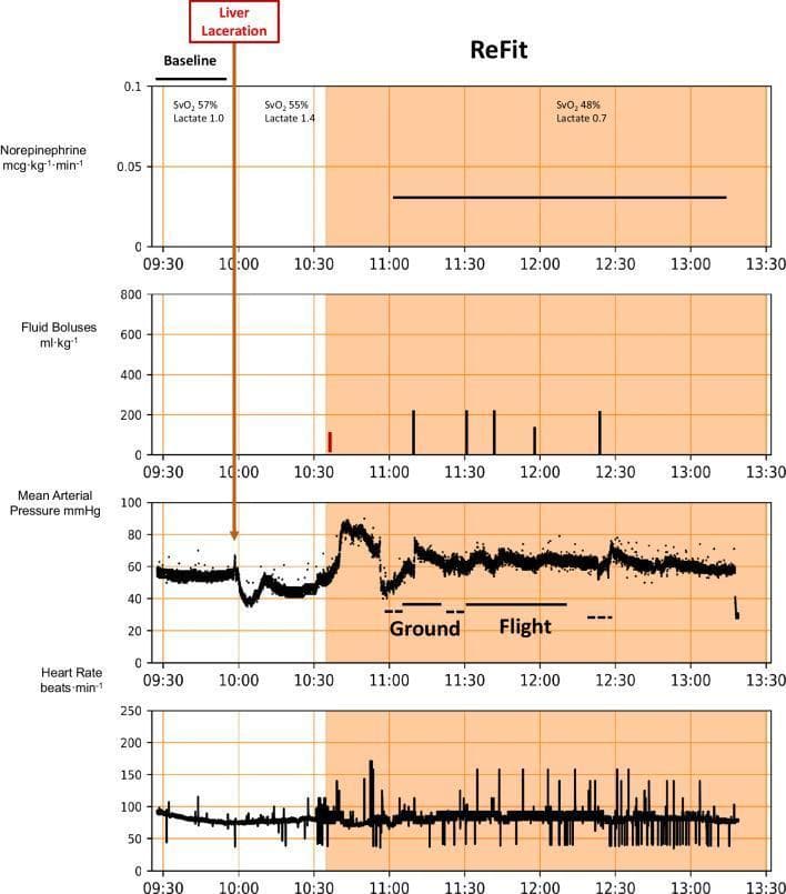 This physiological trend chart displays real-time hemodynamic monitoring data during a 'ReFit' resuscitation protocol following a liver laceration event (indicated at 10:00). The image consists of four vertically stacked graphs sharing a common timeline from 09:30 to 13:30. The parameters tracked include Norepinephrine infusion rate (mcg/kg/min), Fluid Boluses (ml/kg), Mean Arterial Pressure (MAP, mmHg), and Heart Rate (beats/min). Shaded areas indicate the active protocol phase and transportation periods (Ground and Flight). Post-injury, MAP shows a precipitous drop below 40 mmHg, followed by stabilization via the ReFit algorithm through fluid boluses (represented by vertical bars) and a constant norepinephrine infusion of approximately 0.03 mcg/kg/min. Periodic values for SvO2 and Lactate levels are annotated at specific time points. The 'Ground' and 'Flight' transport phases illustrate the stability of MAP (maintained at ~60 mmHg) and heart rate during patient transfer. This educational material demonstrates physiological management of hemorrhagic shock using automated algorithms during multi-modal medical evacuation.
