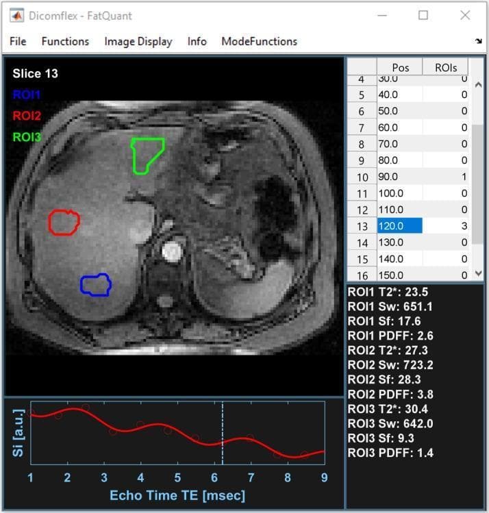 A graphical user interface (GUI) for FatQuant, a medical imaging software application used for liver fat quantification. The interface is divided into four primary quadrants. The top-left quadrant displays a grayscale axial MRI slice (Slice 13) of the upper abdomen, showing the liver and surrounding anatomy. Three colored regions of interest (ROIs) are manually delineated on the liver parenchyma: ROI1 (blue), ROI2 (red), and ROI3 (green). The top-right quadrant contains a data table listing slice positions and the number of ROIs per slice, with slice position 120.0 (Slice 13) highlighted. The bottom-left quadrant features a signal intensity (Si) versus echo time (TE) plot, showing a curve-fitting model (red line) against data points (circles) for one of the ROIs over a range of 1 to 9 msec. The bottom-right quadrant displays calculated quantitative parameters for each ROI, including T2* relaxation time, water signal (Sw), fat signal (Sf), and Proton Density Fat Fraction (PDFF). This interface demonstrates a multi-echo chemical shift-encoded MRI (CSE-MRI) post-processing workflow for assessing hepatic steatosis.