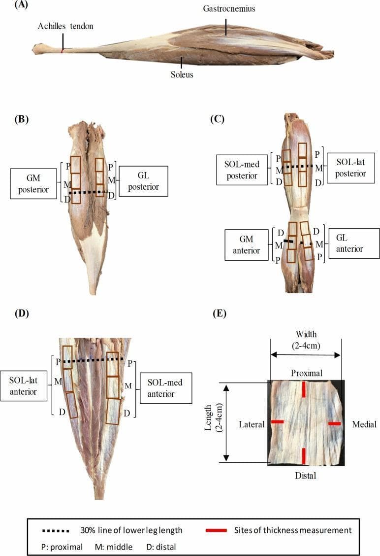 Educational anatomical diagram and specimen preparation of the human triceps surae muscle-tendon unit. (A) Lateral sagittal view demonstrating the spatial relationship between the superiorly positioned gastrocnemius, the underlying soleus, and the distal Achilles tendon. (B-D) Posterior and anterior views of dissected muscles (Gastrocnemius Medialis - GM, Gastrocnemius Lateralis - GL, and Soleus - SOL) illustrating the sites of aponeurosis harvesting. These views are annotated with rectangular grids indicating proximal (P), middle (M), and distal (D) sampling regions, alongside a dashed line representing 30% of the total lower leg length. (E) A high-magnification photograph of a typical rectangular aponeurosis specimen (2-4 cm), marked with specific sites for thickness measurement in both longitudinal and transverse orientations. This figure illustrates musculoskeletal anatomy, aponeurosis morphology, and standardized biomechanical testing preparation for the posterior compartment of the lower leg.