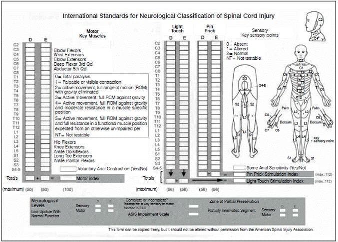 Educational infographic and clinical assessment form titled 'International Standards for Neurological Classification of Spinal Cord Injury (ISNCSCI)', commonly known as the ASIA Impairment Scale. The visual includes a structured data entry form for documenting neurological levels (C2 through S4-5) across motor and sensory domains. The 'Motor Key Muscles' section uses a 0-5 numerical scale to evaluate muscle strength, specifically listing indicators such as elbow flexors (C5), wrist extensors (C6), and ankle plantar flexors (S1). The 'Sensory Key Points' section includes two dermatome maps (anterior and posterior views of the human body) highlighting specific points for testing Light Touch and Pin Prick sensations, scored on a 0-2 scale (0=Absent, 1=Altered, 2=Normal). The form provides sections for calculating Motor and Sensory indices and determining the ASIA Impairment Scale grade (A-E). This diagnostic tool is used in neurology and orthopedics to standardize the evaluation of spinal cord injury severity and recovery progression.
