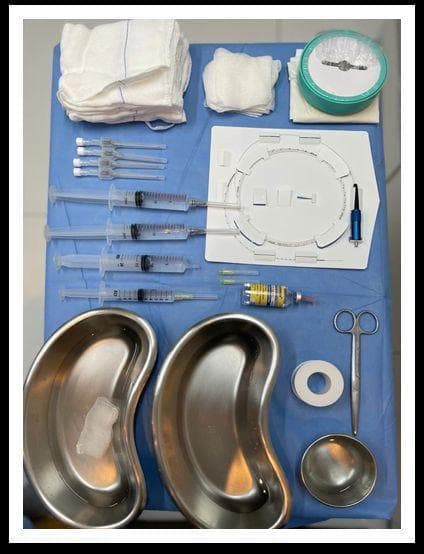 This clinical photograph displays a surgical tray organized for Assisted Total Thermal Ablation (ATTA) of varicose veins, highlighting the materials required for endovenous laser therapy and tumescent anesthesia. The sterile blue field contains several large-volume luer lock syringes (likely 20 mL) pre-filled with clear fluid for tumescent solution and smaller syringes for anesthetic blebs. Visible instruments include intravenous catheters (likely 14G or 16G), a radial laser fiber coiled on its card with a blue connector, and multiple hypodermic needles. Surgical stainless steel equipment includes two kidney basins, one containing sterile gauze, and a small specimen bowl. Additional supplies include a multi-dose vial of local anesthetic with yellow labeling, surgical tape, scissors, and various stacks of sterile gauze pads. This image serves as an educational resource for perioperative nursing and vascular surgery trainees to recognize the standardized tray setup for endolaser procedures.
