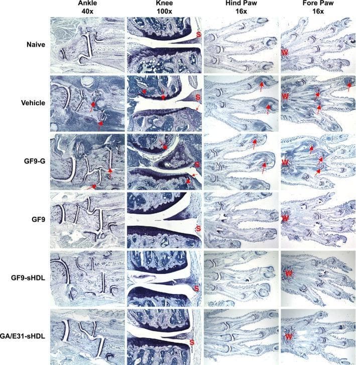 This composite of histological photomicrographs illustrates the joint pathology in a murine model of collagen-induced arthritis (CIA) across various treatment groups. The sections are stained with toluidine blue to visualize proteoglycan content and structural integrity in the ankle (40x), knee (100x), hind paw (16x), and fore paw (16x). Comparison between the 'Naive' and 'Vehicle' or 'GF9-G' control groups reveals marked inflammation, synovial thickening ('S'), pannus formation (small arrows), cartilage destruction (large arrows), and bone resorption (arrowheads) in the arthritic controls. In contrast, mice treated with TREM-1 inhibitory sequences—specifically free GF9, GF9-sHDL, and GA/E31-sHDL—demonstrate significant preservation of joint architecture. These therapeutic groups show increased staining intensity indicating better proteoglycan retention, minimal pannus formation, and reduced inflammatory cell infiltration. Labels 'W' and 'S' indicate the wrist and synovium, respectively. The images provide evidence that ligand-independent TREM-1 inhibition, particularly when delivered via synthetic high-density lipoprotein (sHDL) platforms, protects against the pathological hallmarks of rheumatoid arthritis-like disease.