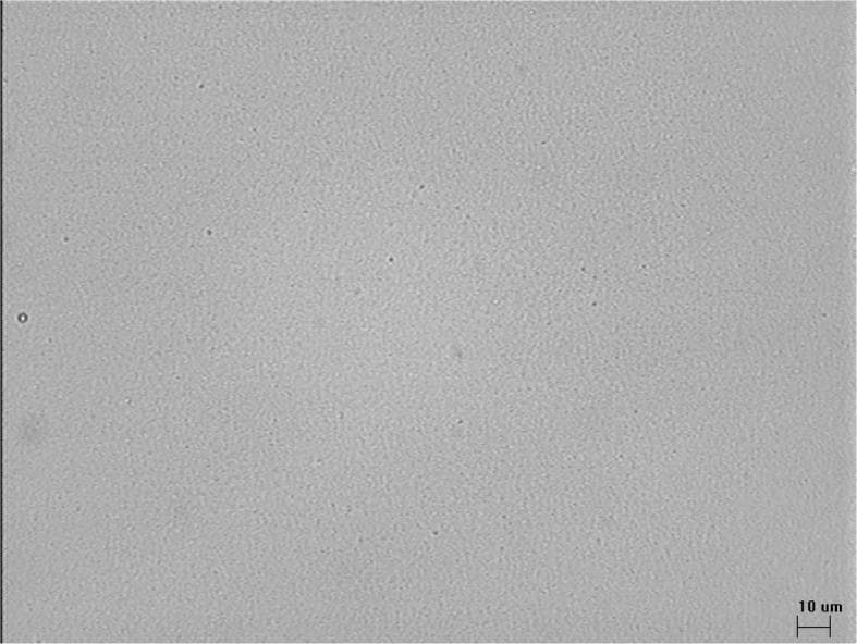 This diagnostic photomicrograph displays a microscopic analysis of a Total Parenteral Nutrition (TPN) admixture, specifically focusing on the stability of lipid emulsions. The image shows a uniform, light grey field of view containing numerous, discrete lipid globules. These droplets appear as small, light, circular features distributed evenly throughout the medium without significant evidence of coalescence or large aggregate formation. A 10 µm scale bar in the bottom right corner facilitates size estimation; the majority of visible particles are sub-micrometer or only a few micrometers in diameter, aligning with safety standards for intravenous administration which require most droplets to remain under 5 µm to prevent fat embolism. The image serves as a representative clinical assessment of pharmaceutical stability after a specific storage duration (8 days refrigerated followed by 24 hours at room temperature), demonstrating that the physical characteristics of the lipid emulsion remain within acceptable therapeutic parameters for patient safety.