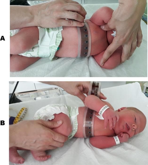Two-panel clinical photograph (A and B) demonstrating a medical procedure in a neonatal setting. The images show a newborn infant placed in a lateral decubitus position on a clinical examination surface for torso shape measurement. An electronic measuring belt—constructed from a flexible, transparent material with integrated, equidistantly spaced dark sensors—is wrapped circumferentially around the infant’s chest. In panel A, the infant's arms are positioned upwards and away from the body, leaving the chest wall relatively uncompressed. In panel B, the arms are positioned downward against the chest, resting between the mattress and the torso, which visibly compresses and alters the cross-sectional shape of the rib cage. A clinician’s hands are visible, stabilizing the infant’s position and securing the sensor belt for data acquisition. The visual content serves to demonstrate the biomechanical impact of posture and limb position on the compliance and deformation of the neonatal chest wall, relevant for respiratory and anthropometric research in pediatrics and neonatology.