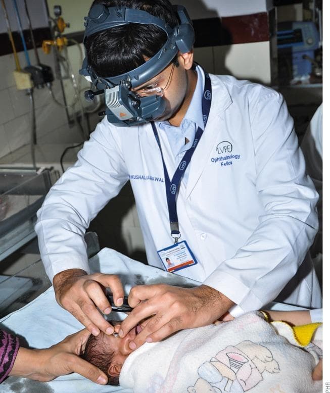 This clinical photograph illustrates a pediatric ophthalmology examination for Retinopathy of Prematurity (ROP) screening. The clinician, identified as an ophthalmology fellow in a white lab coat, is utilizing a head-mounted indirect ophthalmoscope with an integrated light source to visualize the internal structures of the infant's eye. The neonatal patient is positioned supine on a padded surface, with the head stabilized by an assistant's hand. To facilitate a clear view of the fundus, the ophthalmologist is using an eyelid speculum to keep the infant's eye open while holding a condensing lens (not fully visible) over the eye. The image demonstrates the standard technique for binocular indirect ophthalmoscopy (BIO) in a neonatal setting, which is critical for identifying peripheral retinal vascular abnormalities such as ridge formation, extraretinal fibrovascular proliferation, or 'plus disease' in premature infants. This modality is the traditional gold standard for ROP screening, allowing for a wide-field, three-dimensional view of the retina.