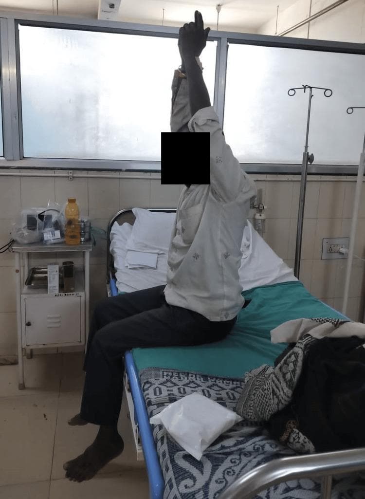 This clinical photograph illustrates a patient performing bedside pulmonary rehabilitation exercises within a hospital setting. The patient is seated upright on the edge of a hospital bed with hips and knees flexed at approximately 90 degrees. One arm is fully extended vertically toward the ceiling with the palm facing inward, demonstrating a thoracic expansion exercise designed to increase lung volume and improve respiratory mechanics. The background features a standard clinical environment, including an IV pole, a bedside table with medical supplies, and a hospital bed with a teal sheet. The photograph serves as an educational visual for physical therapy and cardiorespiratory rehabilitation protocols, specifically for managing extrapulmonary tuberculosis or chronic respiratory conditions. It highlights the integration of active limb movement with breathing techniques to enhance thoracic mobility and reduce dyspnea.