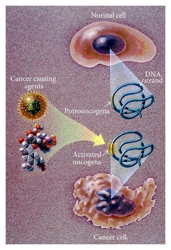 This medical illustration depicts the pathophysiology of carcinogenesis, focusing on the transformation of a normal cell into a cancer cell through oncogene activation. At the top, a normal cell is shown with a regular, rounded plasma membrane and a smooth, oval nucleus. Below it, a cancer cell exhibits characteristic pleomorphism, featuring an irregular, ruffled membrane and a misshapen, hyperchromatic nucleus with an uneven border. The central diagram illustrates the molecular mechanism where 'cancer-causing agents' (represented by viral and chemical structures) interact with a proto-oncogene within a DNA strand. This genetic insult results in the formation of an 'activated oncogene,' represented by a highlighted modification on the DNA coil. The illustration serves as an educational tool to compare normal cellular morphology with malignant alterations and to link these changes to genetic mutations. Key concepts included are cellular ruffling, nuclear atypia, and the transition from proto-oncogene to oncogene as a primary driver of uncontrolled cell growth.