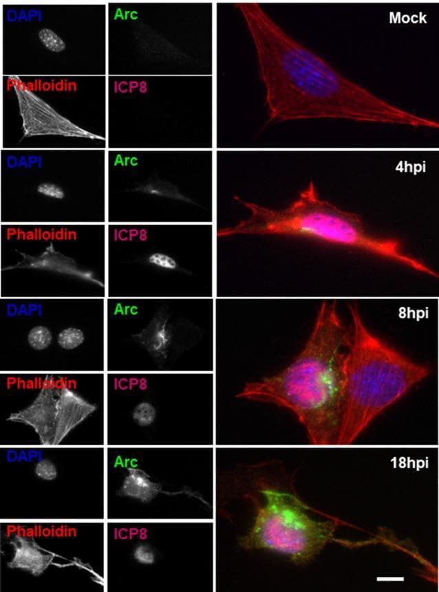 This diagnostic image consists of multi-channel immunofluorescence microscopy panels demonstrating the temporal progression of Herpes Simplex Virus type 1 (HSV-1) infection in HT22 neuronal cells at four time points: Mock (control), 4, 8, and 18 hours post-infection (hpi). Each row displays individual greyscale channels for DAPI (nucleus), Phalloidin (F-actin cytoskeleton), Arc (activity-regulated cytoskeleton-associated protein), and ICP8 (viral replication protein), alongside a merged color composite. In mock-infected cells, Arc and ICP8 signals are negligible. Following infection, ICP8 (pink in merge) shows progressive nuclear localization and intensity increases. Concurrently, Arc protein (green in merge) shows an altered distribution, accumulating significantly in the perinuclear region by 8 and 18 hpi, suggesting an association with the Golgi apparatus during the viral cycle. Phalloidin staining (red in merge) reveals morphological changes, including cell shrinkage and cytoskeletal reorganization by 18 hpi. This comparison illustrates the upregulation and spatial redistribution of synaptic plasticity-related proteins during acute neurotropic viral infection.