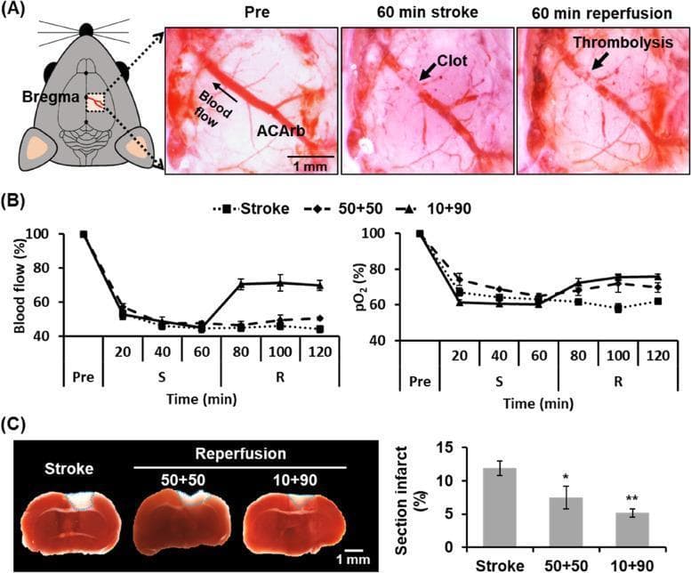 This composite educational graphic illustrates a murine model of stroke and reperfusion (S/R) used to evaluate thrombolysis efficacy. Panel A features dissecting microscope images of the anterior cerebral artery remote branch (ACArb). It visualizes the progression from healthy baseline blood flow ('Pre') to vessel occlusion by a visible thrombus ('60 min stroke') and subsequent clot dissolution following tPA administration ('60 min reperfusion'). Panel B presents line graphs quantifying hemodynamic and metabolic changes: the percentage of blood flow and partial pressure of oxygen (pO2) are plotted over time across pre-treatment, stroke (S), and reperfusion (R) phases, comparing three treatment groups (Stroke control, 50+50 bolus, and 10+90 bolus/infusion). Panel C displays pathological assessment via 2,3,5-triphenyltetrazolium chloride (TTC) staining of brain cross-sections. Healthy tissue appears red, while infarcted tissue is white (demarcated by blue dotted lines). A corresponding bar graph quantifies the infarct area, showing that the 10+90 tPA administration protocol significantly reduces the percentage of brain infarction compared to the stroke control and 50+50 bolus groups.