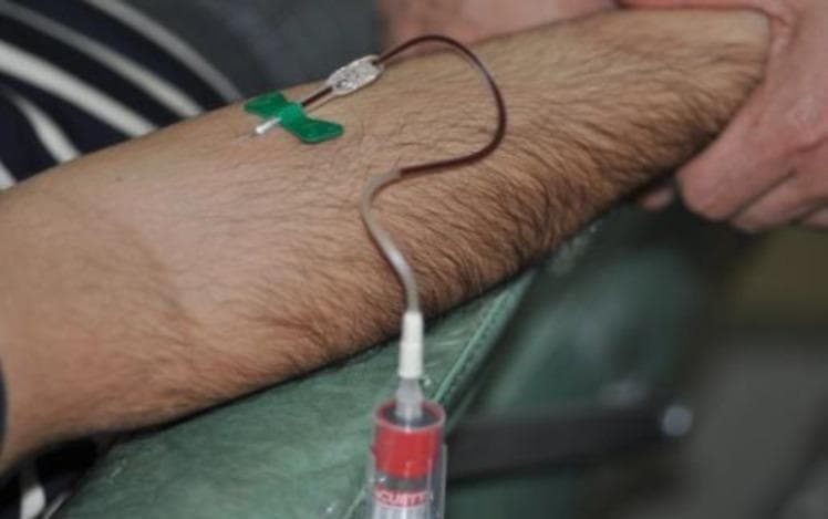 This clinical photograph captures a venipuncture procedure for blood collection, specifically from the brachial vein in the antecubital fossa of a patient's arm. The setup features a winged infusion set (butterfly needle) with a green safety shield, which is inserted into the vein. A flexible plastic extension tube connects the needle to a vacuum collection tube. The collection tube has a red cap, indicating it is likely a plain serum tube without anticoagulants, and is seen partially filled with dark venous blood. The patient's arm is positioned on a green medical cushion, with a practitioner's hand visible providing stabilization. This procedural image demonstrates the initial step in obtaining blood for Platelet-Rich Fibrin (PRF) preparation, highlighting the medical specialty of oral and maxillofacial surgery or regenerative medicine. The educational focus is on the aseptic technique and the specific equipment required for autologous blood harvesting.