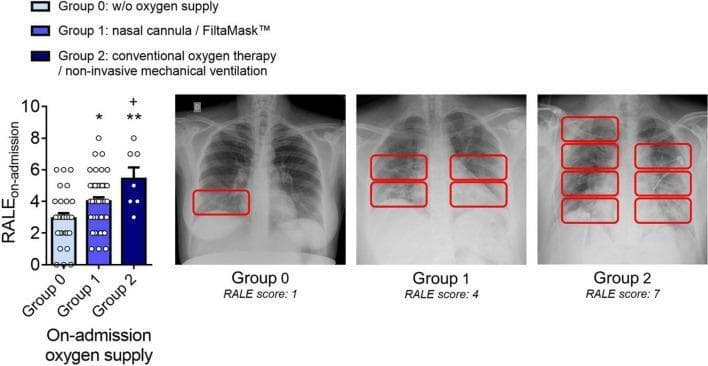 This medical visual combines a bar graph and diagnostic radiographic images to illustrate the correlation between COVID-19 severity and the Radiographic Assessment of Lung Edema (RALE) score. The bar graph on the left shows mean RALE scores at admission for three patient cohorts: Group 0 (mild, no oxygen), Group 1 (moderate, nasal cannula/FiltaMask™), and Group 2 (severe, conventional therapy/non-invasive ventilation). The RALE score increases progressively across these groups, supported by statistical significance markers. To the right, three representative posterior-anterior chest X-rays correspond to each group. Group 0 (RALE 1) shows minimal peripheral opacity in the right lower lobe. Group 1 (RALE 4) demonstrates bilateral mid-to-lower zone opacities. Group 2 (RALE 7) exhibits widespread, dense, bilateral pulmonary opacities involving all lung zones. Red bounding boxes on the X-rays highlight the consolidated or infiltrated areas used for RALE scoring. This content demonstrates the use of standardized radiographic scoring to quantify disease progression and the resulting clinical requirement for respiratory support in viral pneumonia cases.