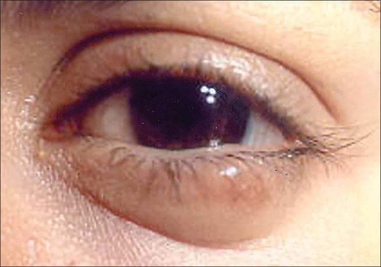 Hugging Face pmc clinical VQA raw