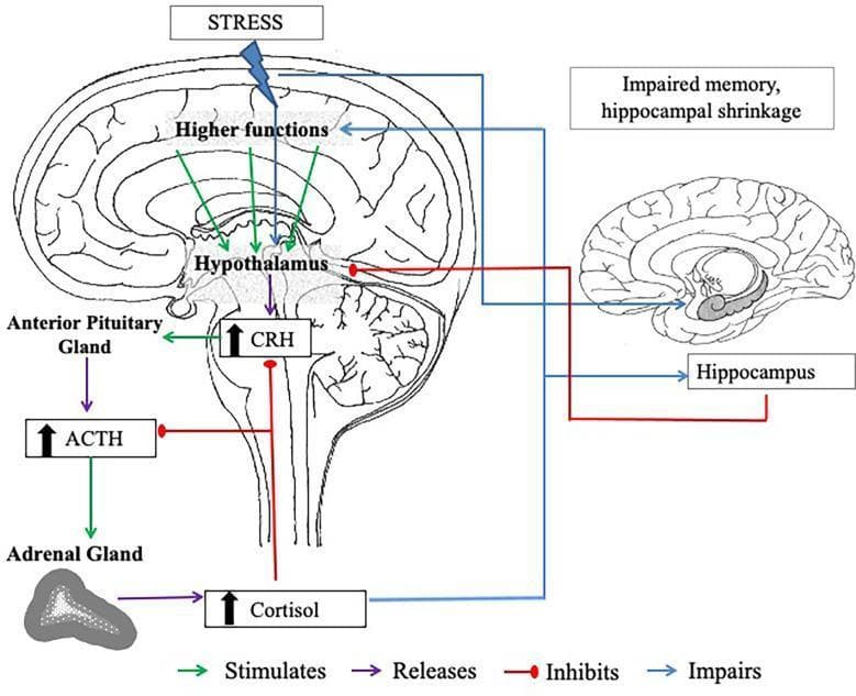 This pathophysiology diagram illustrates the hypothalamic-pituitary-adrenal (HPA) axis and its relationship with the hippocampus under chronic stress conditions. The left side depicts a sagittal section of the brain showing the 'Higher Functions' and the 'Hypothalamus' stimulating the 'Anterior Pituitary Gland' to release corticotropin-releasing hormone (CRH) and adrenocorticotropic hormone (ACTH). These hormones stimulate the 'Adrenal Gland' to secrete cortisol. A negative feedback loop is shown where cortisol inhibits further CRH and ACTH release. The right side of the diagram highlights the clinical impact of chronic cortisol elevation on the 'Hippocampus,' specifically illustrating hippocampal shrinkage and impaired memory. Color-coded arrows define functional relationships: green for stimulation, purple for release, red for inhibition, and blue for impairment. The illustration serves as an educational resource for understanding neuroendocrinology, the physiological stress response, and the long-term neurobiological effects of glucocorticoids on brain morphology and cognitive function.