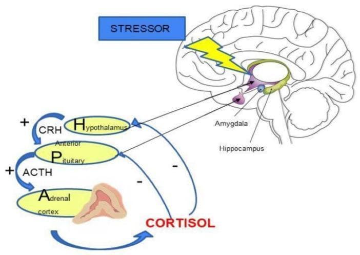 A medical diagram illustrating the regulation of the Hypothalamic-Pituitary-Adrenal (HPA) axis in response to stress. The top-right shows a sagittal cross-section of the human brain, highlighting the amygdala and hippocampus. A 'STRESSOR' box with a yellow lightning bolt icon indicates external stimulus impacting these limbic structures. Below, a flow diagram details the neuroendocrine cascade: positive stimulation (marked with '+') shows the Hypothalamus releasing Corticotropin-Releasing Hormone (CRH) to stimulate the Anterior Pituitary, which in turn releases Adrenocorticotropic Hormone (ACTH) to stimulate the Adrenal Cortex. The Adrenal Cortex releases Cortisol, depicted with blue return arrows labeled with '-' signs, representing the negative feedback loops that inhibit further secretion from both the Hypothalamus and the Anterior Pituitary. This visual resource is used to explain the hormonal response to stress and the homeostatic mechanisms of the endocrine system.