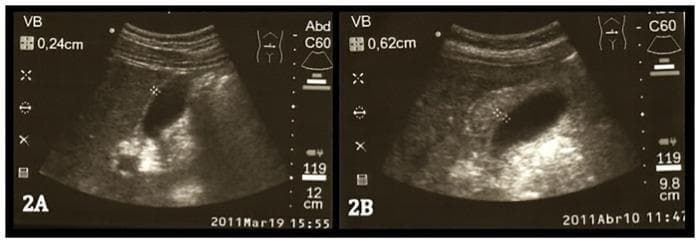 Hugging Face pmc clinical VQA raw