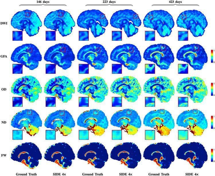 A comparison chart of sagittal pediatric brain MRI scans illustrating the progression of neural development at three time points: 146, 223, and 423 days after birth. The image displays five rows of diagnostic metrics: Diffusion Weighted Imaging (DWI), Generalized Fractional Anisotropy (GFA), Orientation Dispersion (OD), Neurite Density (ND), and Free Water (FW). For each time point, 'Ground Truth' data is compared side-by-side with 'SIDE 4x' reconstructions (undersampled by factor 4). The scans demonstrate longitudinal changes in brain size, morphological maturation, and white matter tract development. Color-coded heatmaps (blue for low values, red for high) visualize quantitative microstructural parameters. Key developmental milestones shown include increasing Neurite Density (ND) and more defined GFA signals in the corpus callosum and brainstem as the infant ages. Each scan includes a red boxed inset providing high-magnification detail of a cortical region, highlighting the fidelity of the SIDE 4x reconstruction method in maintaining structural details compared to the fully sampled ground truth.