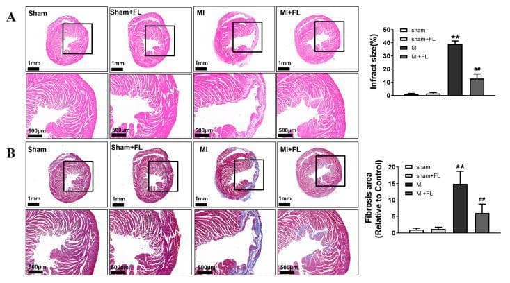 This composite educational graphic displays histopathological sections of mouse hearts used to study myocardial infarction (MI) and the protective effects of Flt3 ligand (FL) treatment. Row A presents Hematoxylin and Eosin (H&E) stained cross-sections showing gross cardiac morphology. The Sham and Sham+FL groups exhibit normal ventricular wall thickness and intact structural integrity. The MI group reveals significant ventricular wall thinning and a distorted cardiac shape, indicative of a large infarct. The MI+FL group shows a preserved ventricular structure with reduced wall thinning compared to the MI group. Row B utilizes Masson's Trichrome staining to highlight fibrosis. Fibrotic tissue is stained blue, while healthy myocardium appears red/pink. Extensive blue collagen deposition is visible in the MI group's infarct region, which is markedly reduced in the MI+FL group. Accompanying bar graphs provide quantitative data for both infarct size and fibrotic area percentage across the four groups (Sham, Sham+FL, MI, MI+FL), demonstrating that FL administration significantly attenuates adverse cardiac remodeling and collagen deposition following LAD-induced ischemia.
