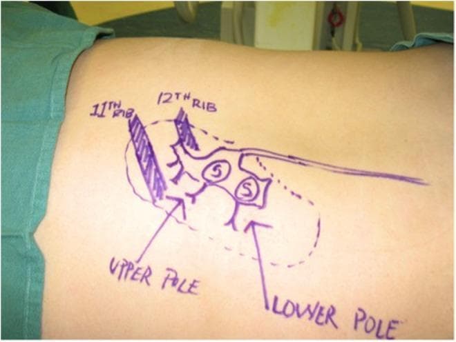 Hugging Face pmc clinical VQA raw