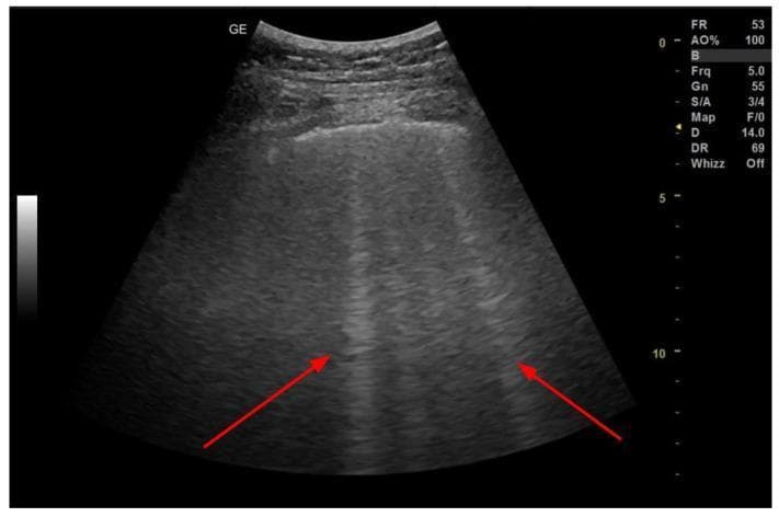 Hugging Face pmc clinical VQA raw