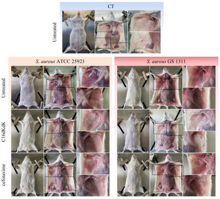 This clinical photograph panel illustrates mammary gland pathology and treatment efficacy in a mouse model of Staphylococcus aureus-induced mastitis. The visual is organized into a healthy control (CT) group and two infection groups (S. aureus ATCC 25923 and S. aureus GS 1311), further subdivided by treatment status: Untreated, C16dKdK (synthetic lipopeptide), and cefotaxime (antibiotic).
Each row displays the external appearance in the first column and internal mammary tissue pathology in the second and third (magnified) columns. Untreated infected groups demonstrate clinical signs of acute mastitis, including external redness and swelling, and internal tissue congestion with prominent hemorrhage.
Comparative analysis shows that mice treated with C16dKdK exhibit a significant reduction in mammary tissue congestion and absence of visible bleeding, appearing similar to the healthy control. In contrast, the cefotaxime-treated group shows partial recovery but retains areas of persistent congestion and pitting bleeding. The image serves as a visual demonstration of the comparative therapeutic efficacy between novel lipopeptides and traditional antibiotics in resolving infectious inflammation of the mammary glands.