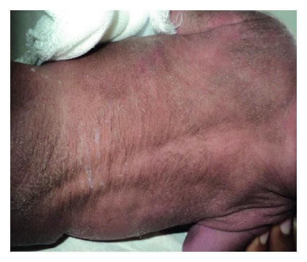 Hugging Face pmc clinical VQA raw