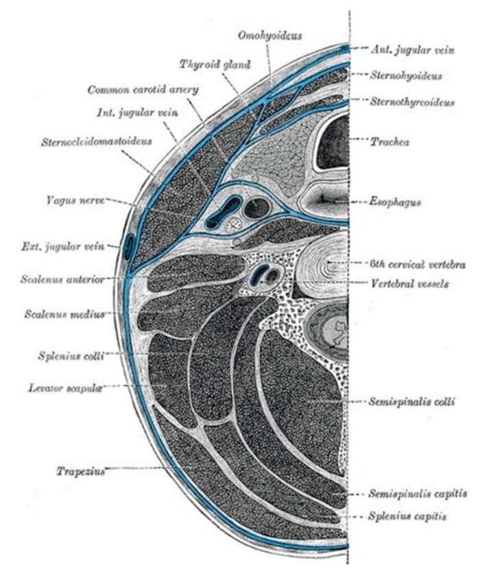 This medical illustration presents a transverse anatomical diagram of the neck at the level of the sixth cervical vertebra (C6), focusing on the compartmentalization provided by the deep cervical fascia (highlighted in blue). The diagram labels several critical structures within these fascial planes. The visceral compartment contains the trachea, esophagus, and thyroid gland. Lateral to the viscera, the carotid sheath is shown enveloping the common carotid artery, internal jugular vein, and vagus nerve. Muscular structures are identified including the sternocleidomastoid and trapezius (investing layer), the strap muscles (omohyoid, sternohyoid, sternothyroid), and the prevertebral/paravertebral muscles (scalenus anterior and medius, longus colli, semispinalis, and splenius groups). Vascular landmarks like the external and anterior jugular veins and vertebral vessels are also depicted. This diagram is designed for educational purposes to demonstrate the spatial relationships of cervical anatomy and the potential pathways for the spread of deep neck space infections.