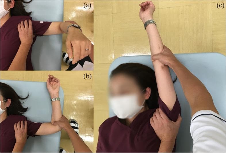 This composite of three clinical photographs (a, b, and c) demonstrates the manual manipulation stages of a glenohumeral joint mobilization procedure, typically performed for adhesive capsulitis or frozen shoulder. The patient is in a supine position. (a) Initial abduction: The right arm is abducted to approximately 90 degrees with the elbow flexed, while the clinician stabilizes the shoulder girdle with one hand to isolate movement. (b) External rotation: From the abducted position, the shoulder is externally rotated to 90 degrees, with the clinician providing support at the elbow and shoulder to prevent compensatory movements or humeral head anterior translation. (c) Maximal abduction: The arm is moved toward full abduction in the frontal plane, with the clinician carefully supporting the humerus and axilla. The sequence highlights clinical techniques used to increase range of motion (ROM) in the shoulder joint while protecting the humerus from excessive torsional forces. This visual is intended for orthopedic and physical medicine training, focusing on controlled passive mobilization and anatomical stabilization during joint manipulation.